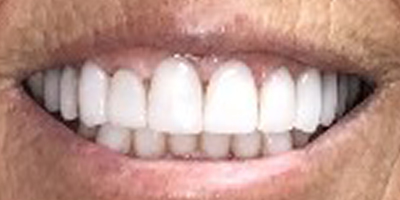 Image for 