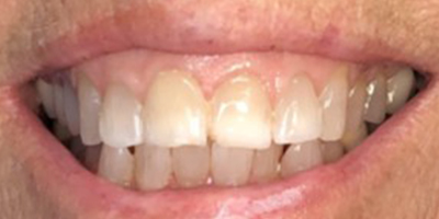 Image for 