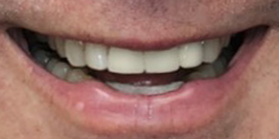 Image for 