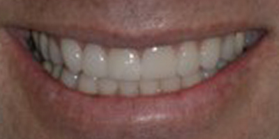 Image for 