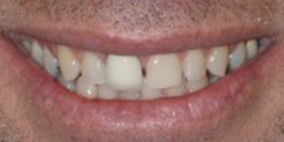 Image for 