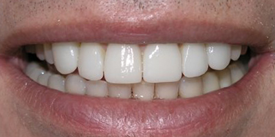 Image for 