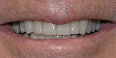 Image for 