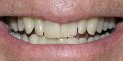 Image for 