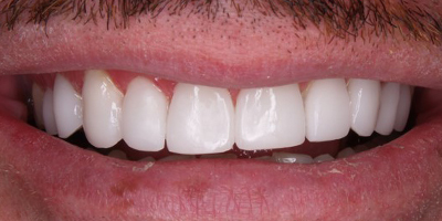 Image for 