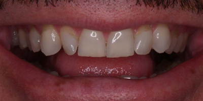 Image for 