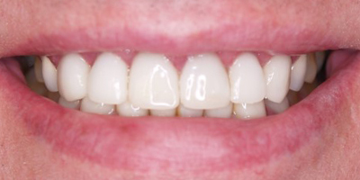 Image for 