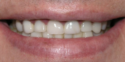 Image for 